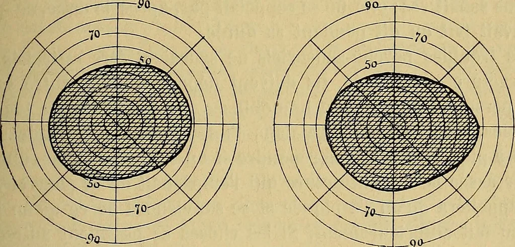 An illustration from Leçons cliniques sur l'hystérie et l'hypnotisme : faites à l'Hôpital Saint-André de Bordeaux, 1891, leaf 270