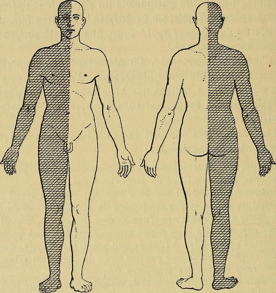An illustration from Leçons cliniques sur l'hystérie et l'hypnotisme : faites à l'Hôpital Saint-André de Bordeaux, 1891, leaf 279