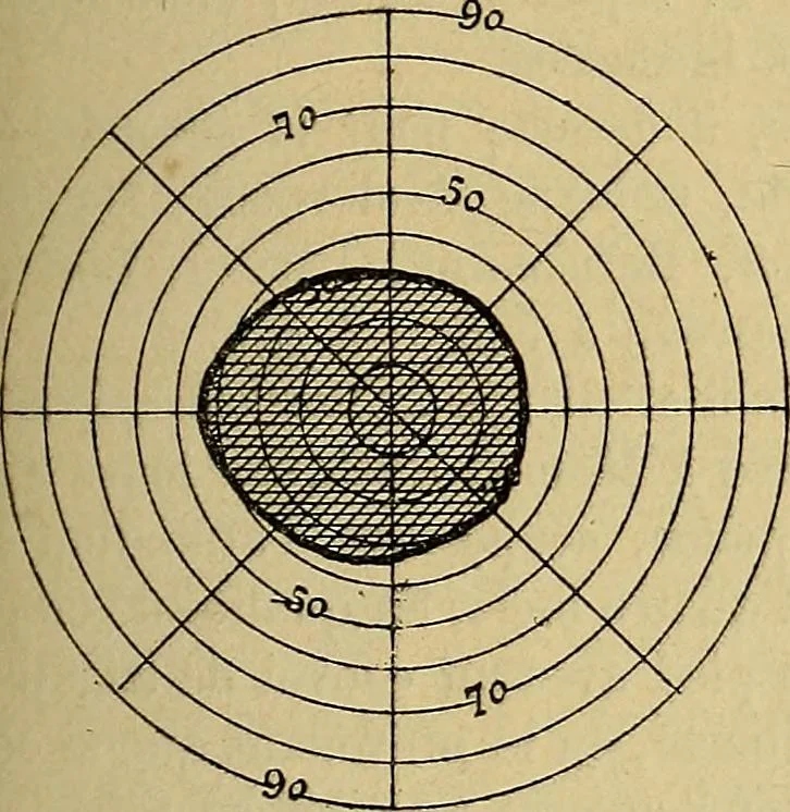 An illustration from Leçons cliniques sur l'hystérie et l'hypnotisme : faites à l'Hôpital Saint-André de Bordeaux, 1891, leaf 280