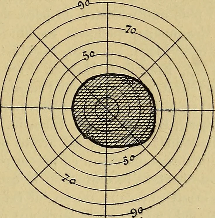 An illustration from Leçons cliniques sur l'hystérie et l'hypnotisme : faites à l'Hôpital Saint-André de Bordeaux, 1891, leaf 280