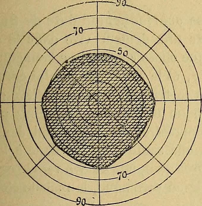 An illustration from Leçons cliniques sur l'hystérie et l'hypnotisme : faites à l'Hôpital Saint-André de Bordeaux, 1891, leaf 332