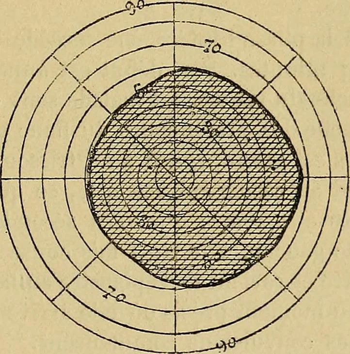 An illustration from Leçons cliniques sur l'hystérie et l'hypnotisme : faites à l'Hôpital Saint-André de Bordeaux, 1891, leaf 332