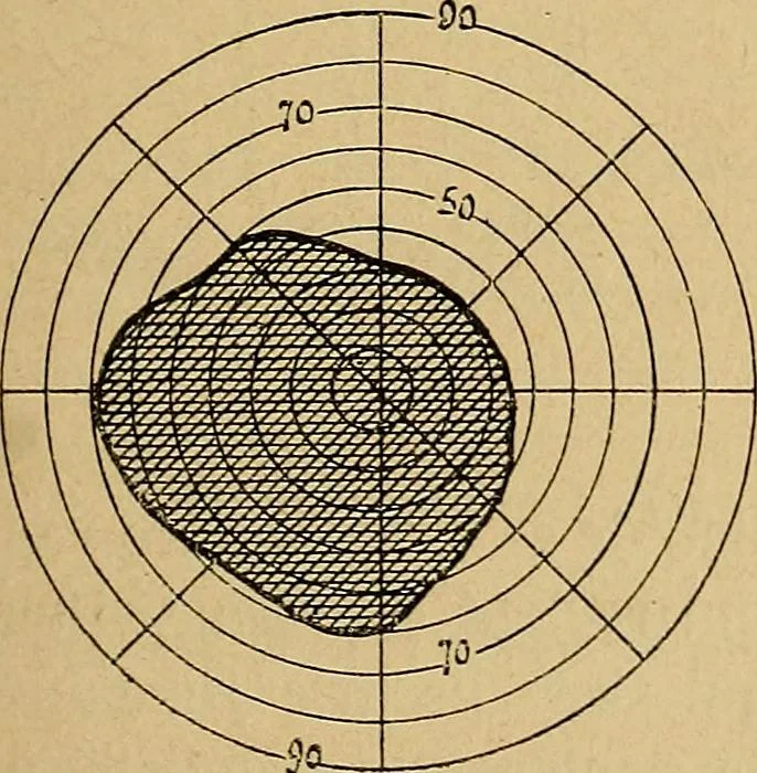 An illustration from Leçons cliniques sur l'hystérie et l'hypnotisme : faites à l'Hôpital Saint-André de Bordeaux, 1891, leaf 34