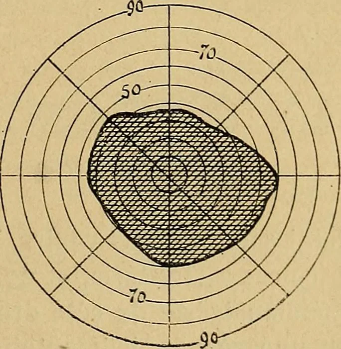 An illustration from Leçons cliniques sur l'hystérie et l'hypnotisme : faites à l'Hôpital Saint-André de Bordeaux, 1891, leaf 34