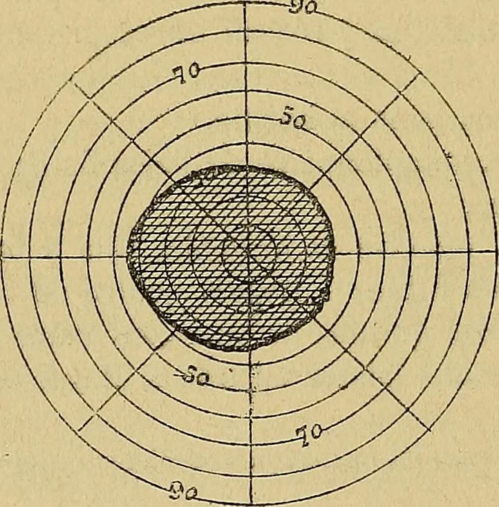 An illustration from Leçons cliniques sur l'hystérie et l'hypnotisme : faites à l'Hôpital Saint-André de Bordeaux, 1891, leaf 359