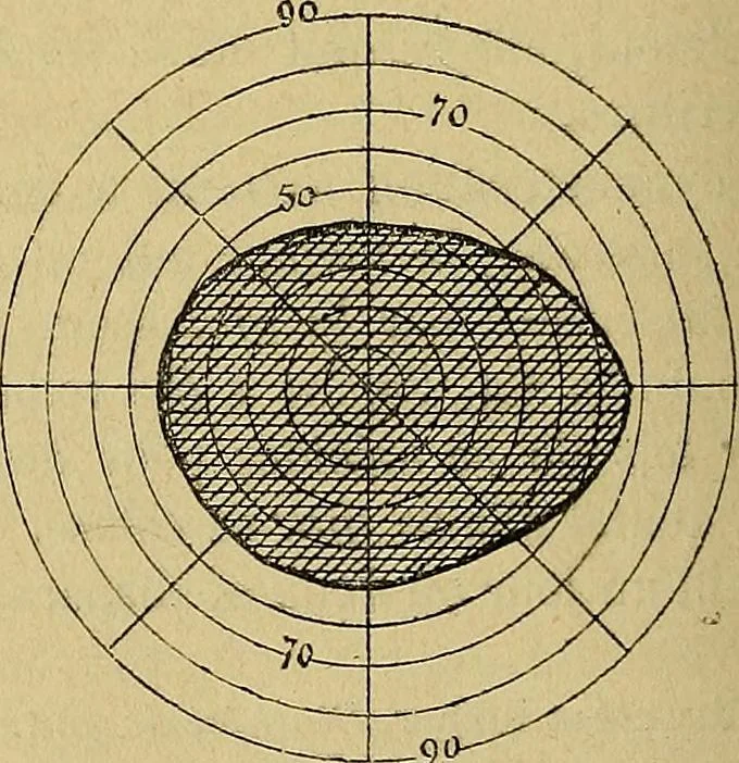 An illustration from Leçons cliniques sur l'hystérie et l'hypnotisme : faites à l'Hôpital Saint-André de Bordeaux, 1891, leaf 359