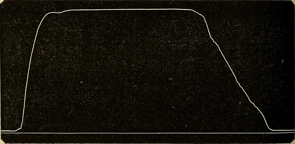 An illustration from Leçons cliniques sur l'hystérie et l'hypnotisme : faites à l'Hôpital Saint-André de Bordeaux, 1891, leaf 361