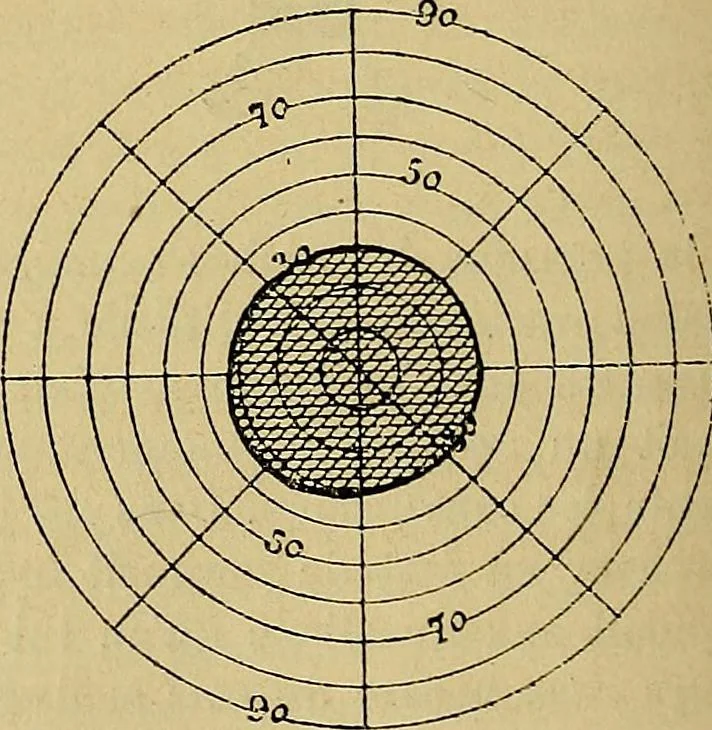An illustration from Leçons cliniques sur l'hystérie et l'hypnotisme : faites à l'Hôpital Saint-André de Bordeaux, 1891, leaf 377