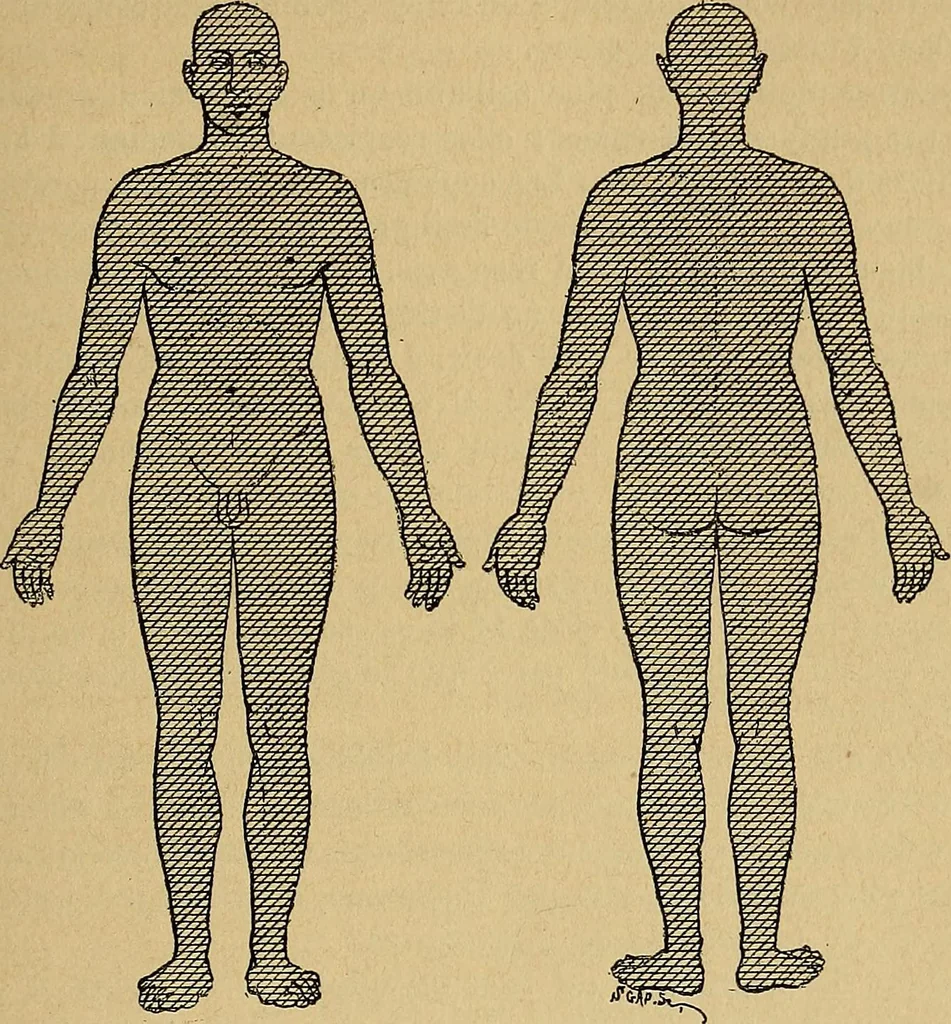 An illustration from Leçons cliniques sur l'hystérie et l'hypnotisme : faites à l'Hôpital Saint-André de Bordeaux, 1891, leaf 38