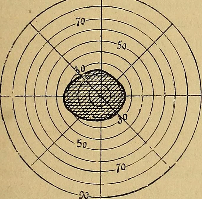An illustration from Leçons cliniques sur l'hystérie et l'hypnotisme : faites à l'Hôpital Saint-André de Bordeaux, 1891, leaf 38