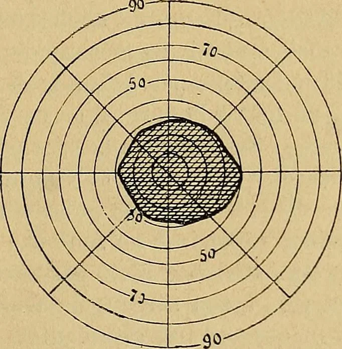 An illustration from Leçons cliniques sur l'hystérie et l'hypnotisme : faites à l'Hôpital Saint-André de Bordeaux, 1891, leaf 38