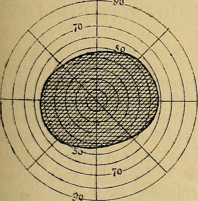 An illustration from Leçons cliniques sur l'hystérie et l'hypnotisme : faites à l'Hôpital Saint-André de Bordeaux, 1891, leaf 380
