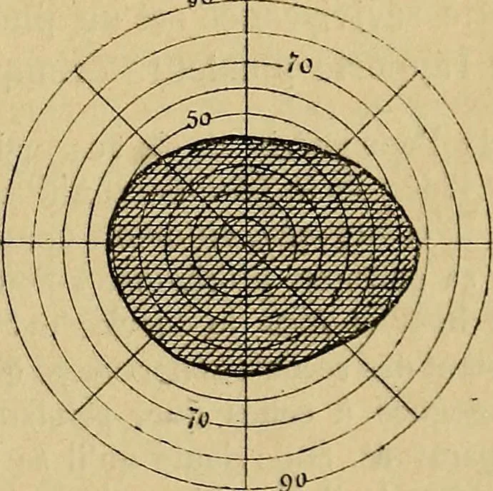 An illustration from Leçons cliniques sur l'hystérie et l'hypnotisme : faites à l'Hôpital Saint-André de Bordeaux, 1891, leaf 380