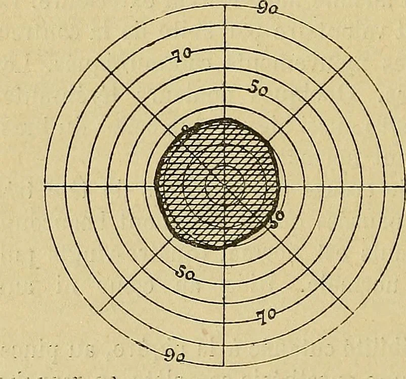 An illustration from Leçons cliniques sur l'hystérie et l'hypnotisme : faites à l'Hôpital Saint-André de Bordeaux, 1891, leaf 417