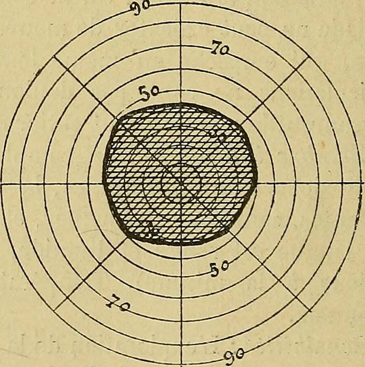 An illustration from Leçons cliniques sur l'hystérie et l'hypnotisme : faites à l'Hôpital Saint-André de Bordeaux, 1891, leaf 417