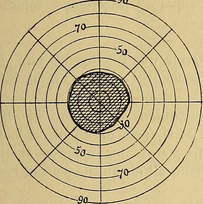 An illustration from Leçons cliniques sur l'hystérie et l'hypnotisme : faites à l'Hôpital Saint-André de Bordeaux, 1891, leaf 432