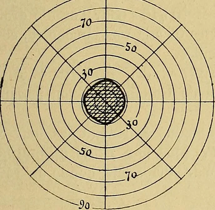 An illustration from Leçons cliniques sur l'hystérie et l'hypnotisme : faites à l'Hôpital Saint-André de Bordeaux, 1891, leaf 454