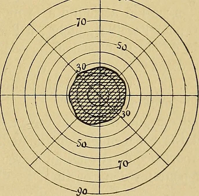 An illustration from Leçons cliniques sur l'hystérie et l'hypnotisme : faites à l'Hôpital Saint-André de Bordeaux, 1891, leaf 454