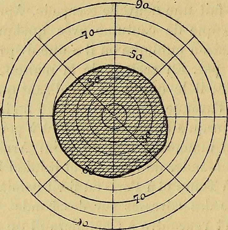 An illustration from Leçons cliniques sur l'hystérie et l'hypnotisme : faites à l'Hôpital Saint-André de Bordeaux, 1891, leaf 519