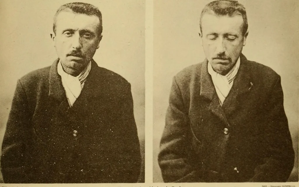 An illustration from Leçons cliniques sur l'hystérie et l'hypnotisme : faites à l'Hôpital Saint-André de Bordeaux, 1891, leaf 524