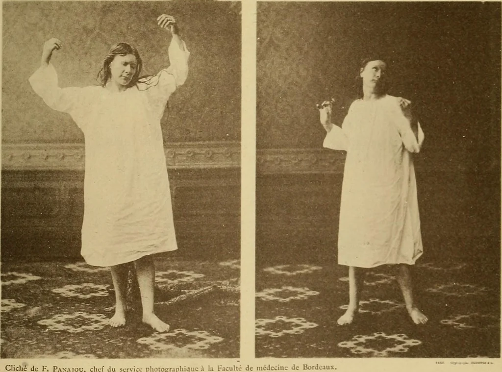 An illustration from Leçons cliniques sur l'hystérie et l'hypnotisme : faites à l'Hôpital Saint-André de Bordeaux, 1891, leaf 526