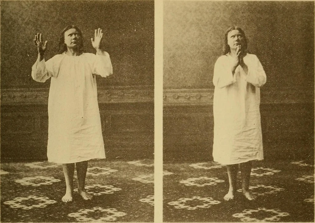 An illustration from Leçons cliniques sur l'hystérie et l'hypnotisme : faites à l'Hôpital Saint-André de Bordeaux, 1891, leaf 528