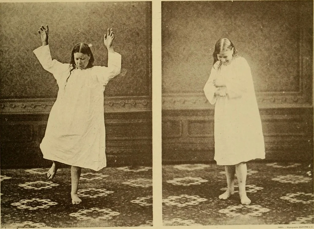 An illustration from Leçons cliniques sur l'hystérie et l'hypnotisme : faites à l'Hôpital Saint-André de Bordeaux, 1891, leaf 530