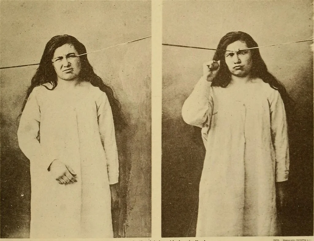 An illustration from Leçons cliniques sur l'hystérie et l'hypnotisme : faites à l'Hôpital Saint-André de Bordeaux, 1891, leaf 536