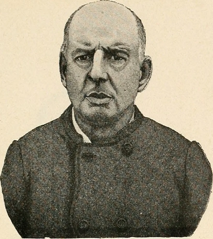 An illustration from Les criminels : étude concernant 859 condamnés, 1900, leaf 420