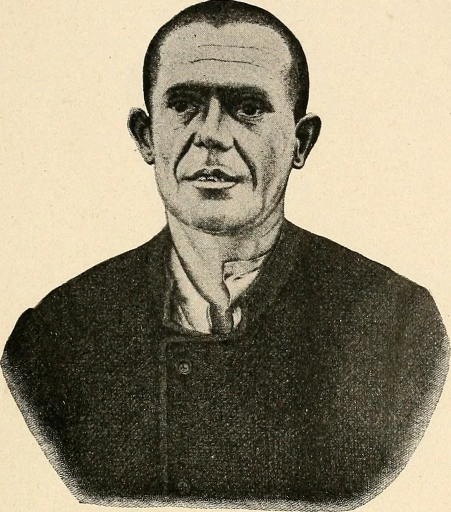 An illustration from Les criminels : étude concernant 859 condamnés, 1900, leaf 426
