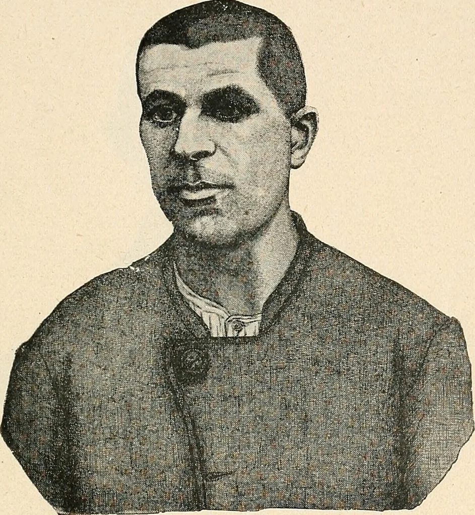 An illustration from Les criminels : étude concernant 859 condamnés, 1900, leaf 430
