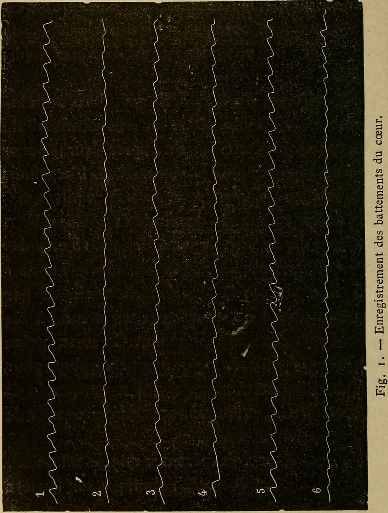 An illustration from Le somnambulisme provoqué : études physiologiques et psychologiques, 1886, leaf 53