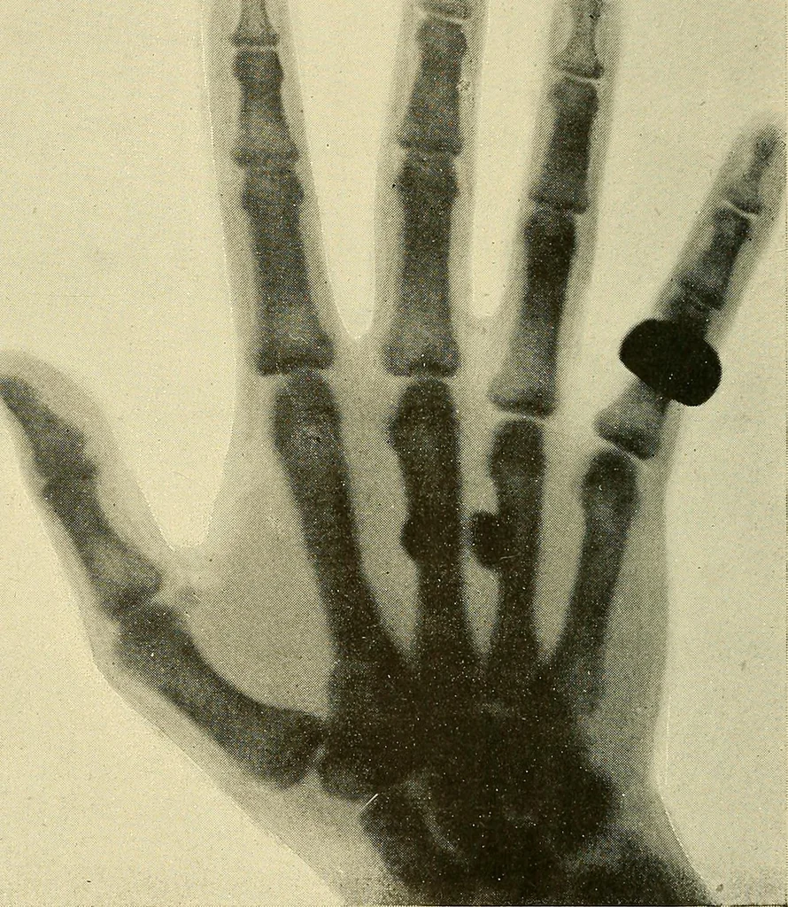 An illustration from Les rayons X et la photographie a travers les corps opaques, 1896, leaf 105