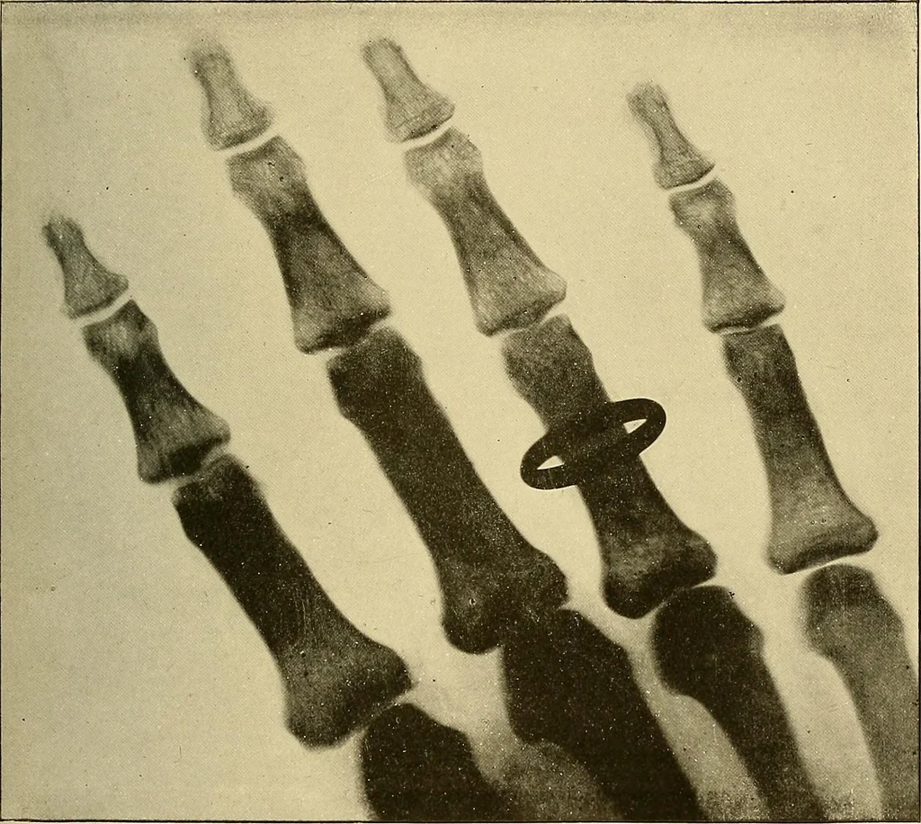 An illustration from Les rayons X et la photographie a travers les corps opaques, 1896, leaf 106