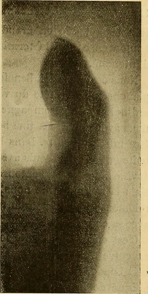 An illustration from Les rayons X et la photographie a travers les corps opaques, 1896, leaf 132