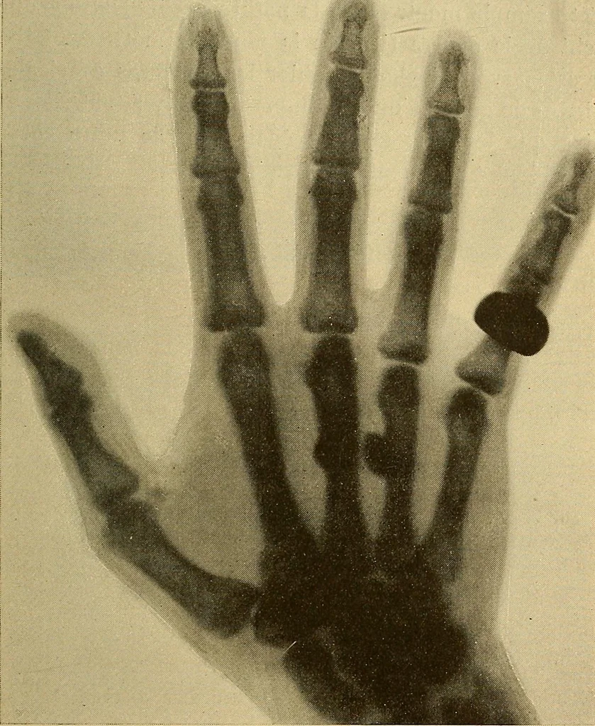 An illustration from Les rayons X et la photographie a travers les corps opaques, 1896, leaf 134