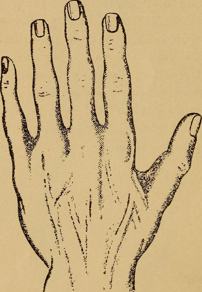 An illustration from Lessons in palmistry; studies of the eye and planetary influences, 1901, leaf 23