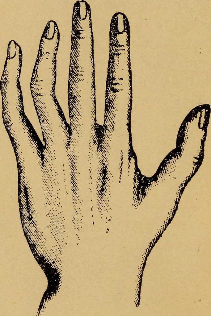 An illustration from Lessons in palmistry; studies of the eye and planetary influences, 1901, leaf 25