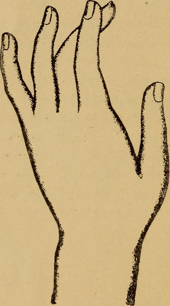 An illustration from Lessons in palmistry; studies of the eye and planetary influences, 1901, leaf 27