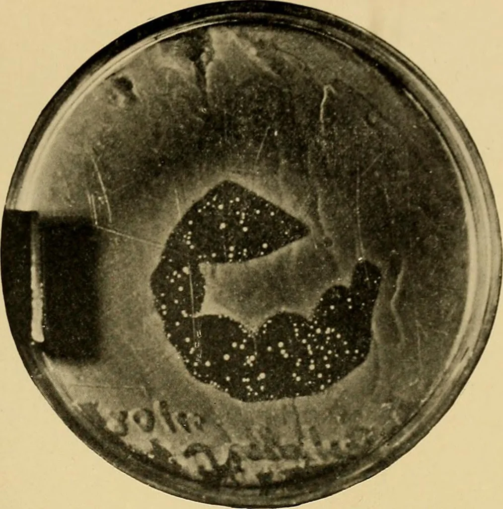 An illustration from Light energy, its physics, physiological action and therapeutic applications, 1904, leaf 210