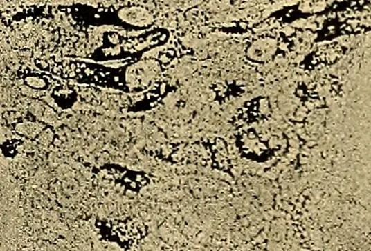 An illustration from Light energy, its physics, physiological action and therapeutic applications, 1904, leaf 282