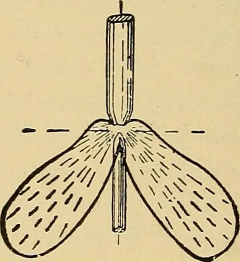 An illustration from Light energy, its physics, physiological action and therapeutic applications, 1904, leaf 427