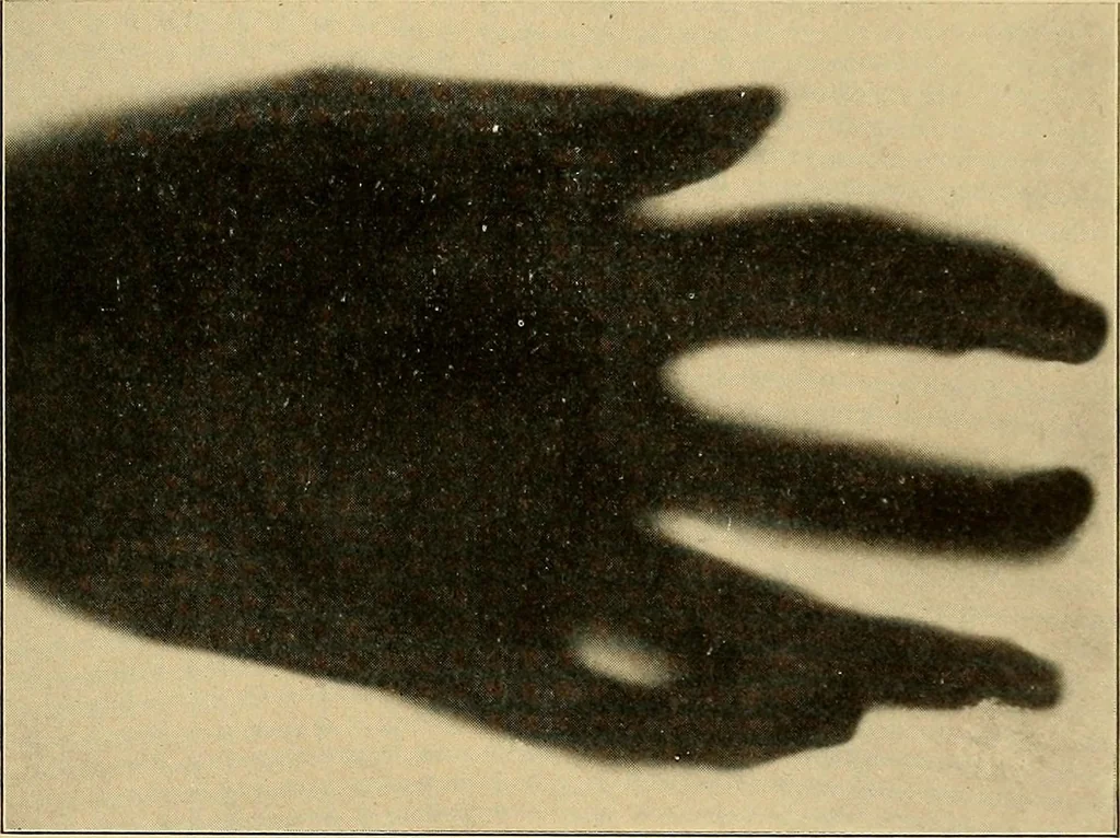 An illustration from Light energy, its physics, physiological action and therapeutic applications, 1904, leaf 770