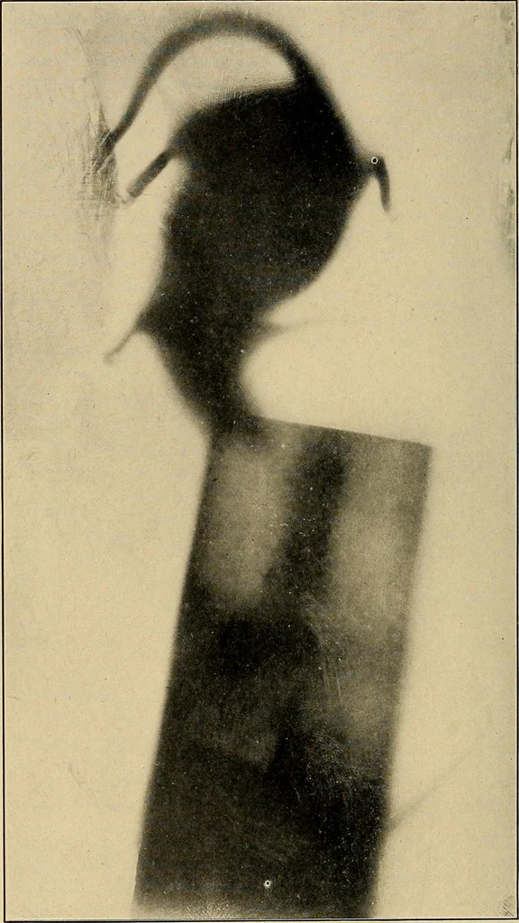 An illustration from Light energy, its physics, physiological action and therapeutic applications, 1904, leaf 773