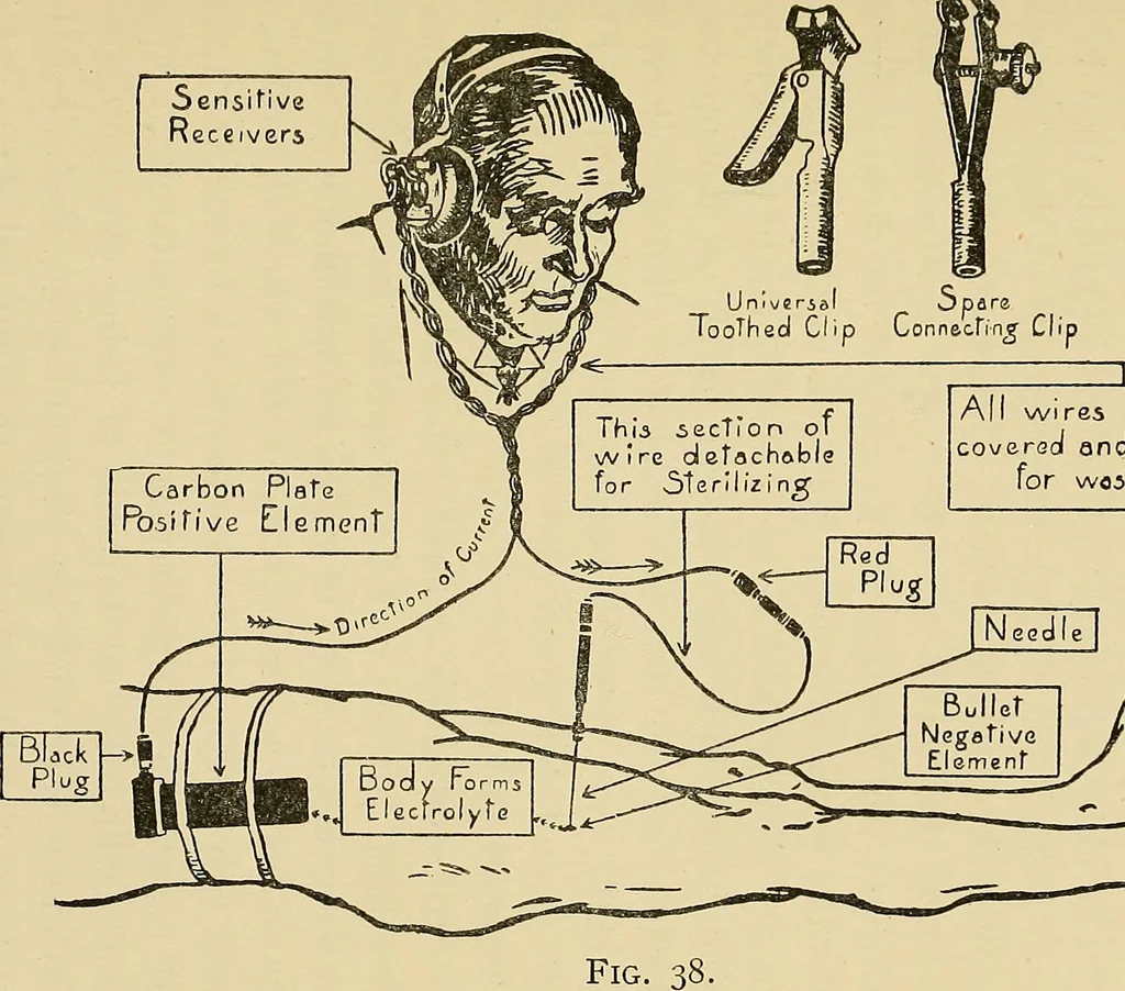 An illustration from Localization by X-rays and stereoscopy, 1916, leaf 104