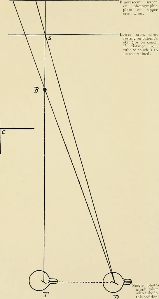 An illustration from Localization by X-rays and stereoscopy, 1916, leaf 110