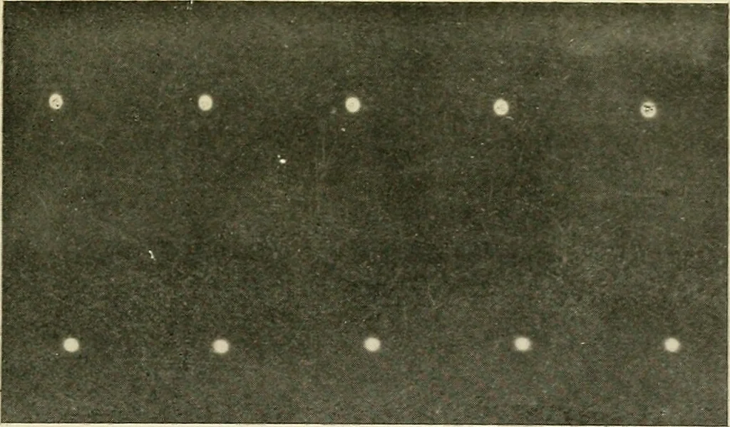 An illustration from Localization by X-rays and stereoscopy, 1916, leaf 22
