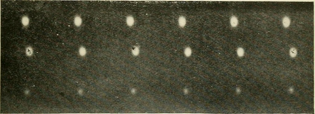 An illustration from Localization by X-rays and stereoscopy, 1916, leaf 22