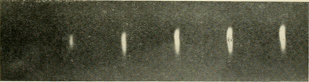 An illustration from Localization by X-rays and stereoscopy, 1916, leaf 22