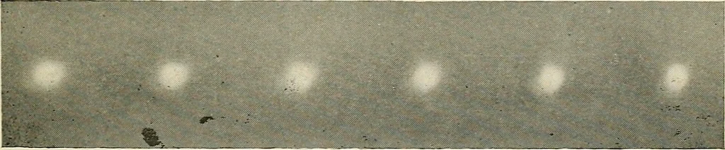 An illustration from Localization by X-rays and stereoscopy, 1916, leaf 22